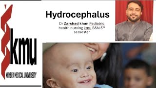 hydrocephalus pediatric health nursing kmu BSN 5th semester [upl. by Llecrad]