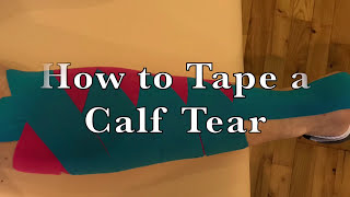 How to Apply Kinesiology Tape for Tape Calf Tear Gastrocnemius Taping [upl. by Shig450]