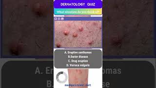 Cutaneous Signs and Diagnosis Quiz  Part 1 medicalmcqs dermatologyquiz [upl. by Rosella398]