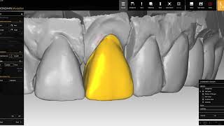 Diseño dental CadCam Zirconzahan [upl. by Cadmar]