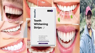 Masofta Teeth Whitening Strips  Honest Review [upl. by Mckay]