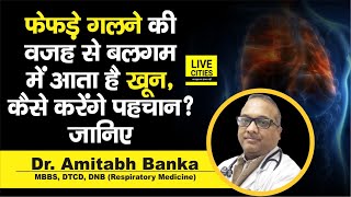 Dr Amitabh Banka से जानिए Major Causes of Blood in Cough क्या है  कैसे होता है इलाज  LiveCities [upl. by Kilar]