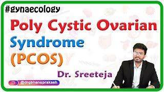 Poly Cystic Ovarian Syndrome PCOS  Stein–Leventhal syndrome  Hyperandrogenic anovulation [upl. by Alfonzo]