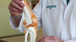 What is Runner’s Knee  Pain in knee when walking  Runners Knee Pain [upl. by Aicila]