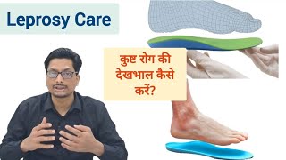 Leprosy Care  कुष्ट रोग की देखभाल  leprosy disease in hindi  kust rog ki dawa  kust rog kya hai [upl. by Eirrehc]