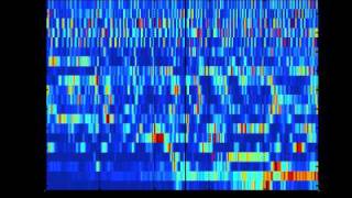 SCHIZOPHRENIA AS SOUND listening to the dynamic brain [upl. by Lledal]