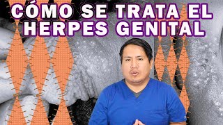 COMO ELIMINAR EL HERPES GENITAL [upl. by Woodson422]