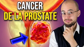 Les symptômes du CANCER de la PROSTATE que vous devez connaitre [upl. by Reffineg]