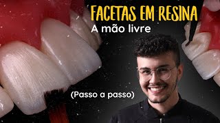 Tutorial Como Fazer a Camada de Esmalte de Facetas em Resina Composta a Mão Livre 2 [upl. by Lutero]