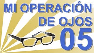 OPERACIÓN DEL SEGUNDO OJO  Experiencia personal operación ojos lentes intraoculares C05 [upl. by Laiceps]