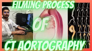 How to make Films of CT Scan Aortography Aortogram Aortic Angiography radiologytechnologist [upl. by Audra]