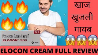 Elocon Cream Full review Effects and Side Effects Best for Fungal Infection खाज खुजली गायब 🔥😃👍😎 [upl. by Nosnek122]