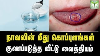 Home Remedies To Cure Blisters On Tongue  Tamil Health Tips [upl. by Haskins818]