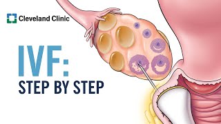 How Does In Vitro Fertilization IVF Work A StepbyStep Explanation [upl. by Nailimixam412]