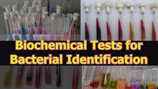 BIOCHEMICAL TESTS FOR BACTERIAL IDENTIFICATION [upl. by Oswell]