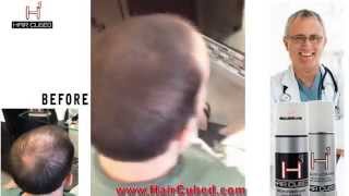 Thinning Hair Problem  New Solution for Hair Loss HAIR CUBED® [upl. by Arianie844]