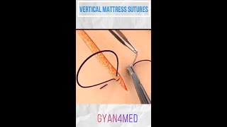 Vertical Mattress Suture  Best Suture Techniques [upl. by Mitzl428]