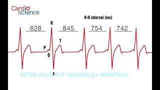 MODULO 6 CALCULO DE LA FRECUENCIA CARDIACA [upl. by Siwel]