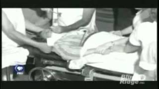 Lobotomy  PBS documentary on Walter Freemanmp4 [upl. by Biel]