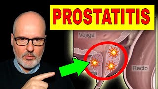 PROSTATITIS AGUDA y CRÓNICA Síntomas Causas y Tratamiento [upl. by Nerrej]