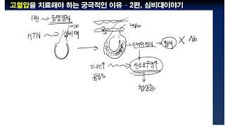 고혈압을 치료해야 하는 궁극적 이유 2편  심비대이야기 [upl. by Stanfield]