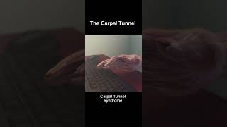 The Carpal Tunnel Syndrome in 22 seconds😯 [upl. by Monteria]