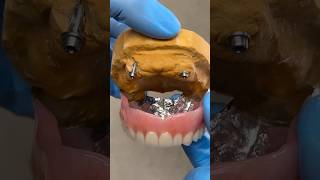 Metal Locator Process Denture lsk121shorts dentist [upl. by Oinotnaocram555]