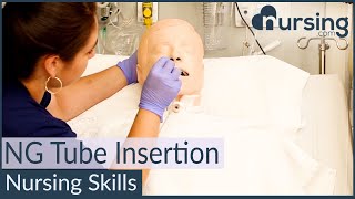 NG Nasogastric Tube Insertion Techniques Nursing Skills [upl. by Plath417]