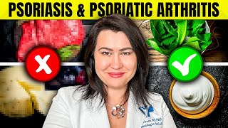 8 WORST Foods for Psoriasis And Psoriatic Arthritis [upl. by Ishmul592]