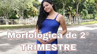 Morfológica de 2° trimestre • Com vídeo da ultrassom [upl. by Donegan9]