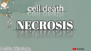 Necrosis and types of necrosis pathology robbins [upl. by Maxentia]