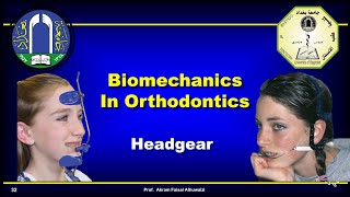 Use of headgear in Orthodontics [upl. by Nairolf]