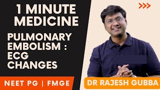 Medicine in 1 Minute  Pulmonary Embolism ECG ARDS  NEET PG FMGE Rapid Revision By Dr Rajesh Gubba [upl. by Killarney335]