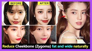 How to reduce Cheekbone fat and wide Zygomatic bone reduction without surgery  Exercise amp Massage [upl. by Mita]