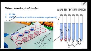 Lab diagnosis of salmonella  simplified salmonella typhi lab diagnosis [upl. by Harbird]