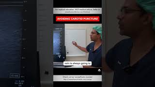 Avoiding Carotid Puncture  shorts cvc anesthesiology nurse [upl. by Teresa738]