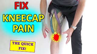 How To Fix Pain In The Front Of The Knee Runners knee [upl. by Eppie]