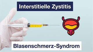 Interstitielle Zystitis  Diagnose Symptome Therapie Blasenschmerzsyndrom [upl. by Rivera]