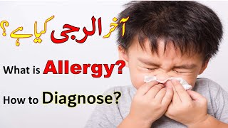 What is Allergy  Allergy Diagnosis  alergy kia hai   allergy ko diagnose kesy kia jay  urdu [upl. by Suhail]