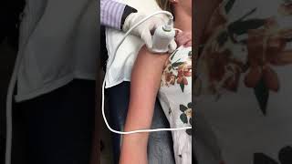 Bicep Tendon Injection  Elite Sports Medicine  Lethbridge [upl. by Sokcin]