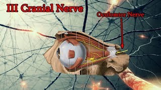 Oculomotor Nerve Palsy III Cranial Nerve palsy Medical animation [upl. by Arlette728]