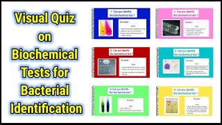 Visual Quiz on Biochemical tests for identification of bacteria  basicappliedmicrobiology [upl. by Nolyaj]