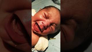 Baby crying stomach cramps😰newbornbabymedicalviral [upl. by Nomelif]