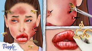 ASMR Satisfying Bee Sting Treatment For Ariana Animation  Severely Injured Animation [upl. by Ettesyl]