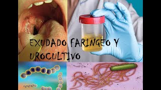 Exudado faríngeo y Urocultivo en Laboratorio [upl. by Leicester]