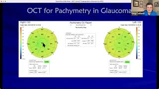 OCT and OCT Angiography for Glaucoma [upl. by Benedick903]