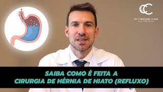 SAIBA COMO É FEITA A CIRURGIA DE HÉRNIA DE HIATO REFLUXO [upl. by Vokay]