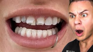 Orthodontist Reacts To WEIRDEST Teeth On TikTok [upl. by Osnofledi410]