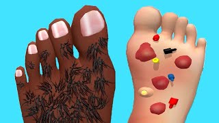 Foot Clinic  Gameplay Walkthrough  All Levels IOS Android [upl. by Hi]