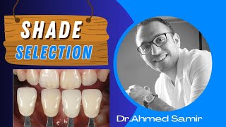 Shade Selection  Dr Ahmed Samir [upl. by Namara447]